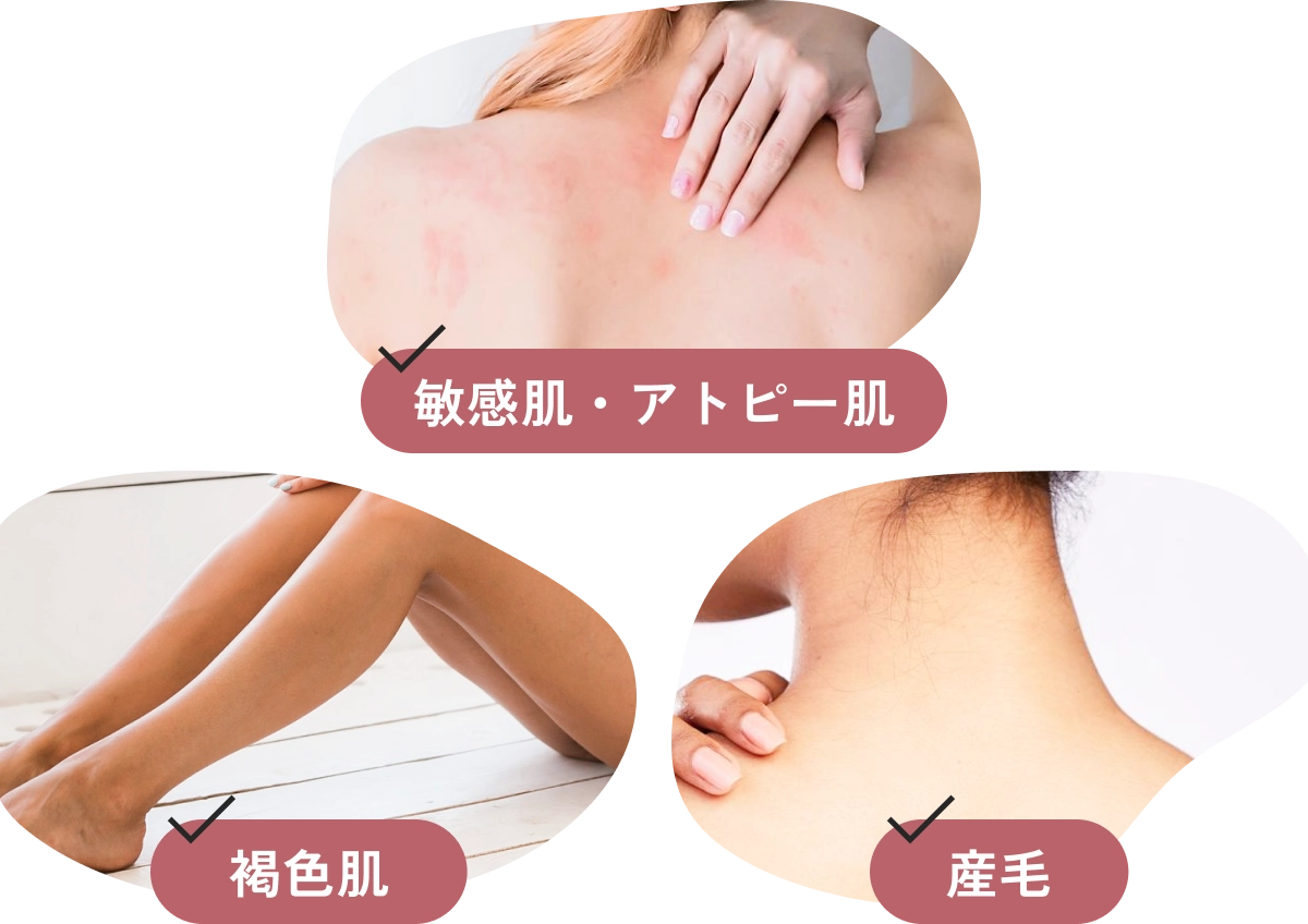 敏感肌・アトピー肌、褐色肌、産毛