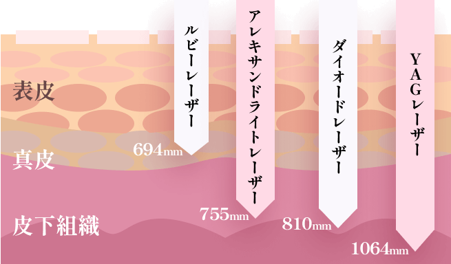 1台で産毛、剛毛の両方に対応