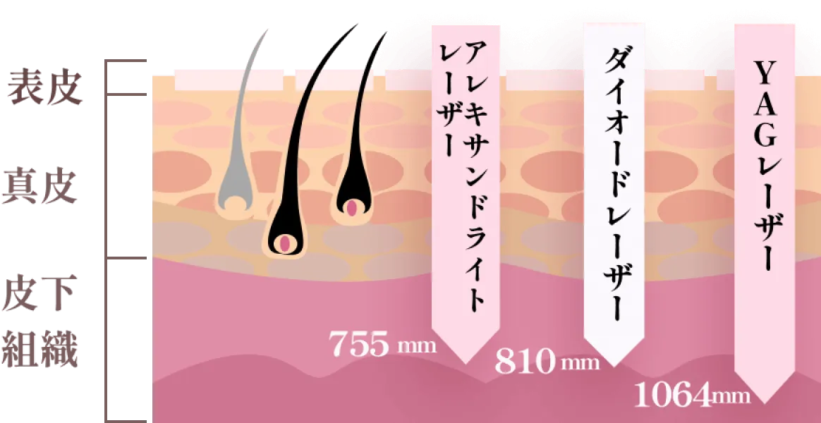 point2 slider2