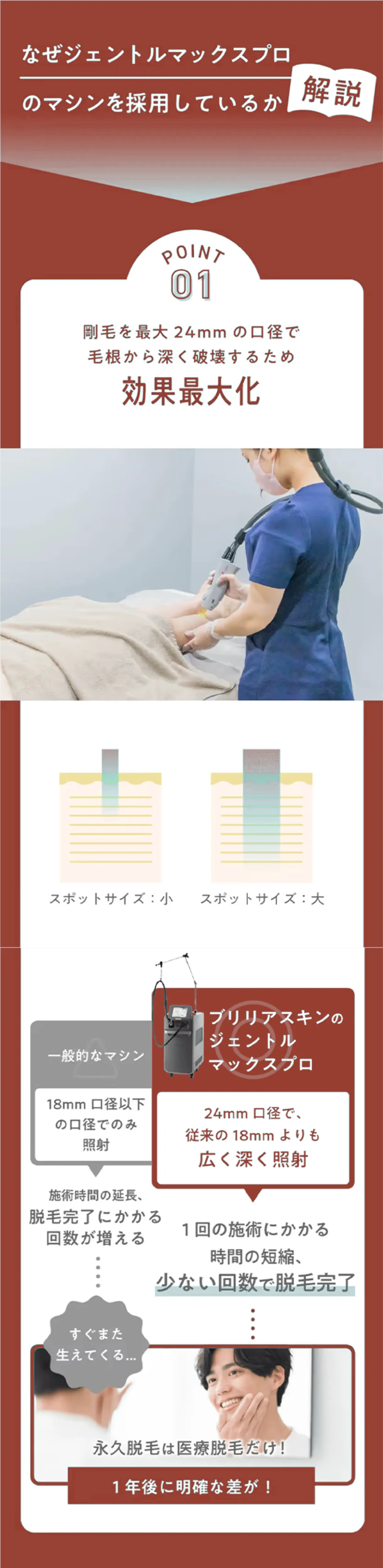 なぜジェントルマックスプロを採用しているのか解説 剛毛を最大24mmの口径で毛根から深く破壊するため効果最大化