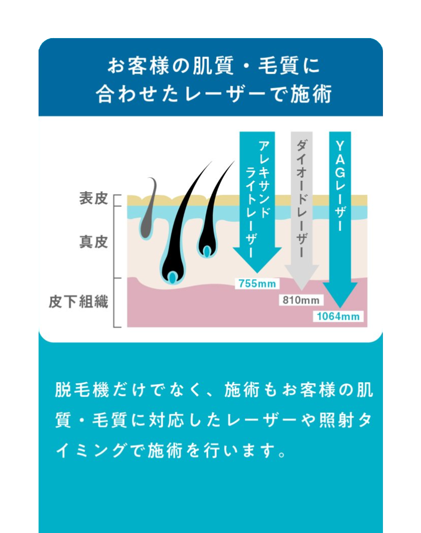 お客様の肌質・毛質に合わせたレーザーで施術 脱毛器だけでなく、施術もお客様の肌質・毛質に対応したレーザーや照射タイミングで施術を行います。